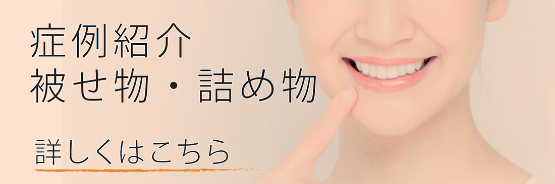 症例紹介 被せ物・詰め物